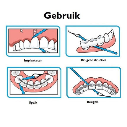 iDontix X-floss lite - Voordeel 3 x 30st