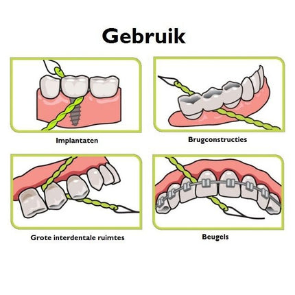 iDontix X-floss regular - Voordeel 3 x  30st